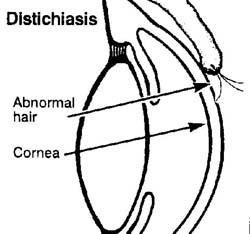 Distichiasis